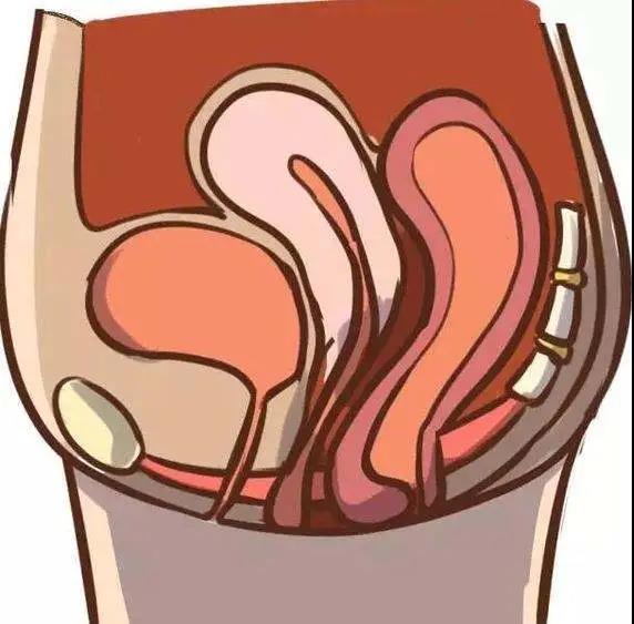 生完娃后,为什么一定要进行盆底肌修复,妈妈们一定要重视起来