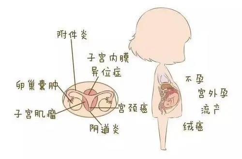 每天认真洗私处,还是有妇科炎症?这个细节大部分人都忽略了!