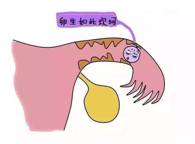 备孕老是失败,因为你经常做这些傻事